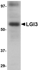 Anti-LGI3 Antibody