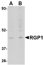 Anti-RGP1 Antibody