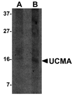 Anti-UCMA Antibody