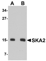 Anti-SKA2 Antibody