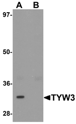 Anti-TYW3 Antibody