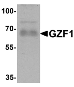 Anti-GZF1 Antibody