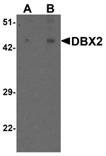 Anti-DBX2 Antibody
