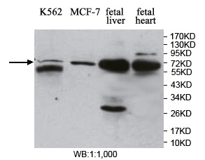 Anti-MBD4 Antibody