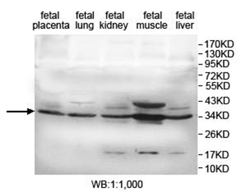 Anti-KDSR Antibody