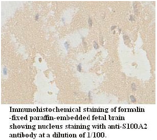 Anti-S100A2 Antibody