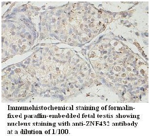 Anti-ZNF432 Antibody