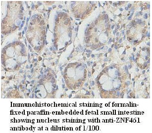 Anti-ZNF461 Antibody