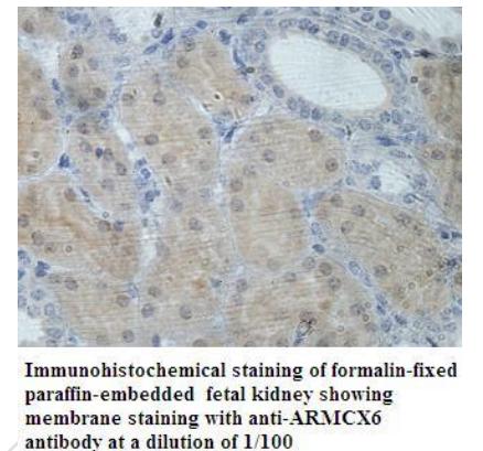 Anti-ARMCX6 Antibody