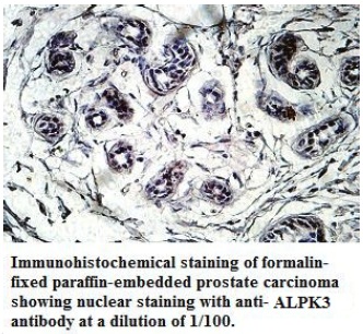 Anti-ALPK3 Antibody