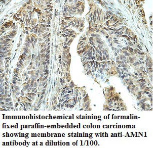 Anti-AMN1 Antibody