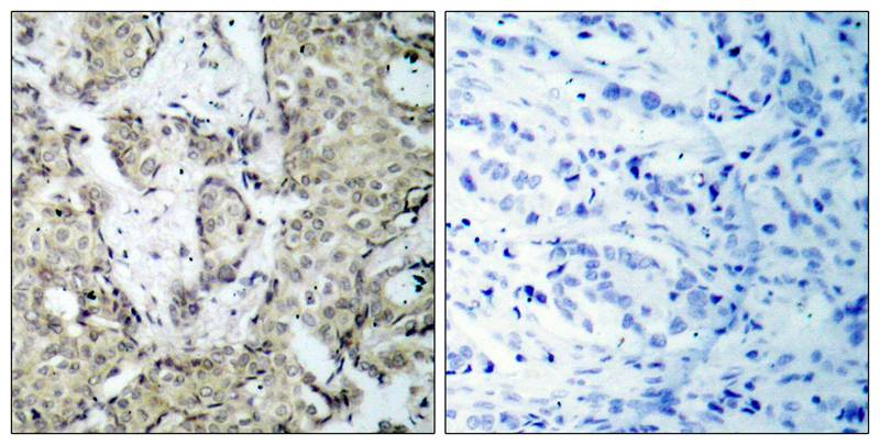 Anti-MKK3 (Phospho-Ser189) Antibody Anti-MKK3 (Phospho-Ser189) Antibody