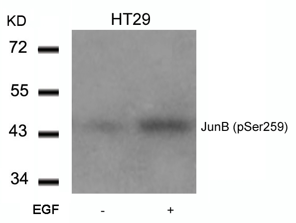 Anti-JunB (Phospho-Ser259) Antibody