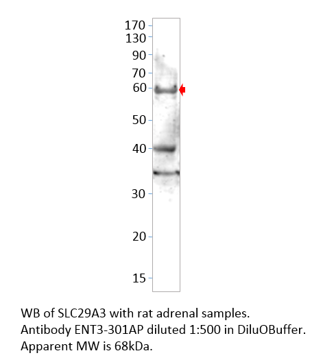 Anti-SLC29A3 Antibody