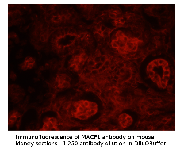 Anti-MACF1 Antibody