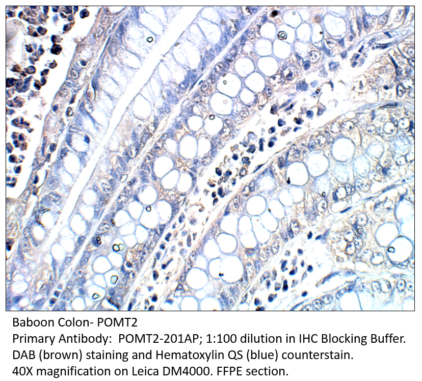 Anti-POMT2 Antibody