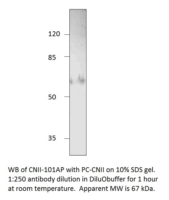 Anti-NT5C2 Antibody