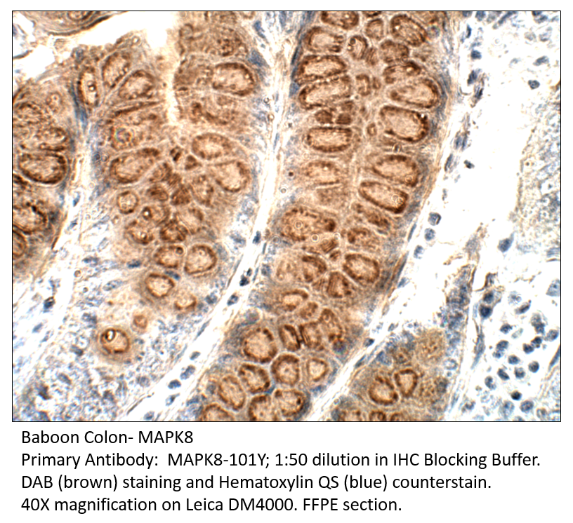 Anti-MAPK8 Antibody Anti-MAPK8 Antibody