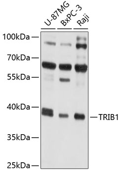 Anti-TRIB1 Antibody