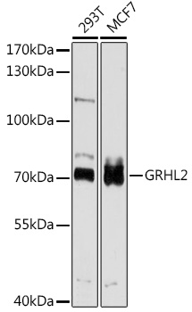 Anti-GRHL2 Antibody
