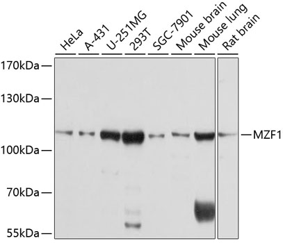 Anti-MZF1 Antibody