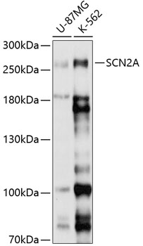 Anti-SCN2A Antibody