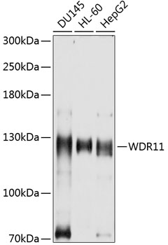 Anti-WDR11 Antibody
