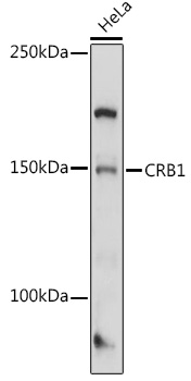 Anti-CRB1 Antibody