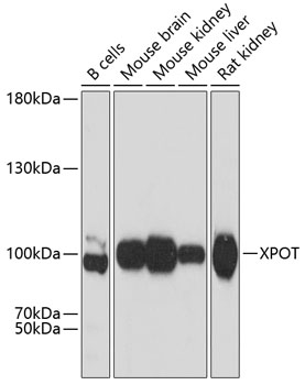 Anti-XPOT Antibody