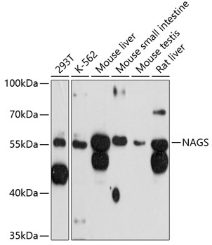 Anti-NAGS Antibody