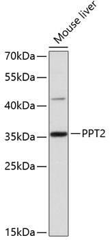 Anti-PPT2 Antibody