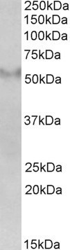 Anti-FSD1 Antibody
