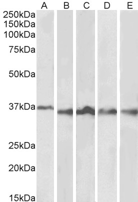 Anti-Aurora B Antibody