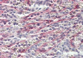 Anti-Stabilin-1 Antibody