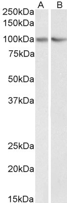 Anti-TRIM71/LIN41 Antibody