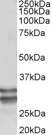 Anti-KLF13 Antibody