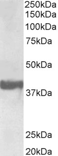 Anti-SH3GL2 Antibody