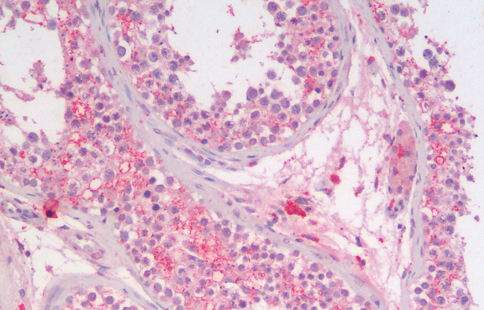 Anti-SGTA Antibody Anti-SGTA Antibody