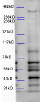 Anti-WDFY3 Antibody