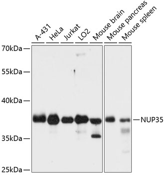 Anti-NUP35 Antibody