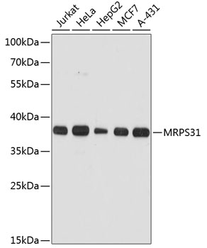 Anti-MRPS31 Antibody