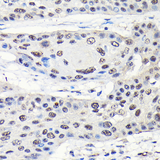 Anti-GTPBP4 / NOG1 Antibody Anti-GTPBP4 / NOG1 Antibody