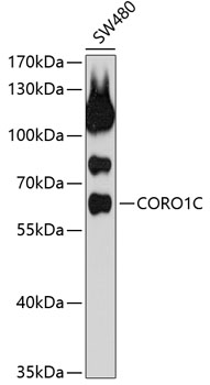 Anti-Coronin-1C Antibody