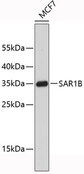 Anti-SAR1B Antibody