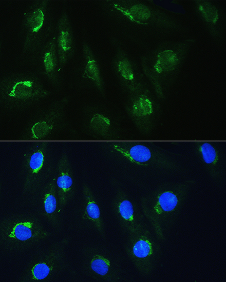 Anti-NBAS Antibody Anti-NBAS Antibody