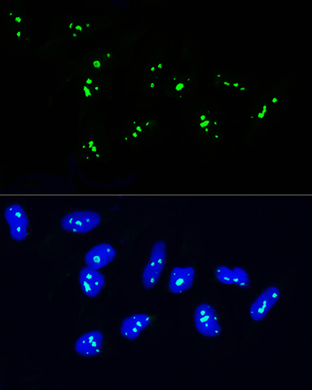 Anti-NOP58 Antibody Anti-NOP58 Antibody