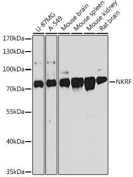 Anti-NKRF Antibody