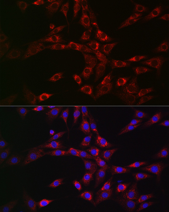 Anti-CHMP6 / VPS20 Antibody Anti-CHMP6 / VPS20 Antibody