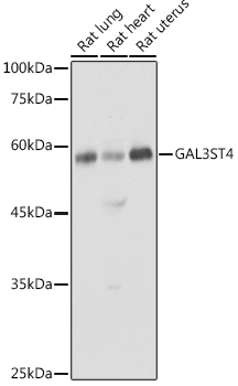 Anti-GAL3ST4 Antibody