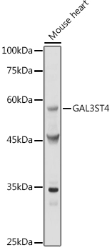 Anti-GAL3ST4 Antibody Anti-GAL3ST4 Antibody
